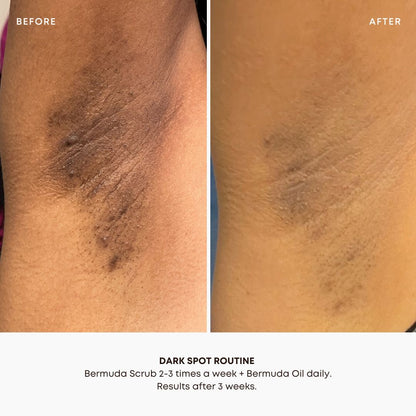 Bermuda Dark Spot Oil