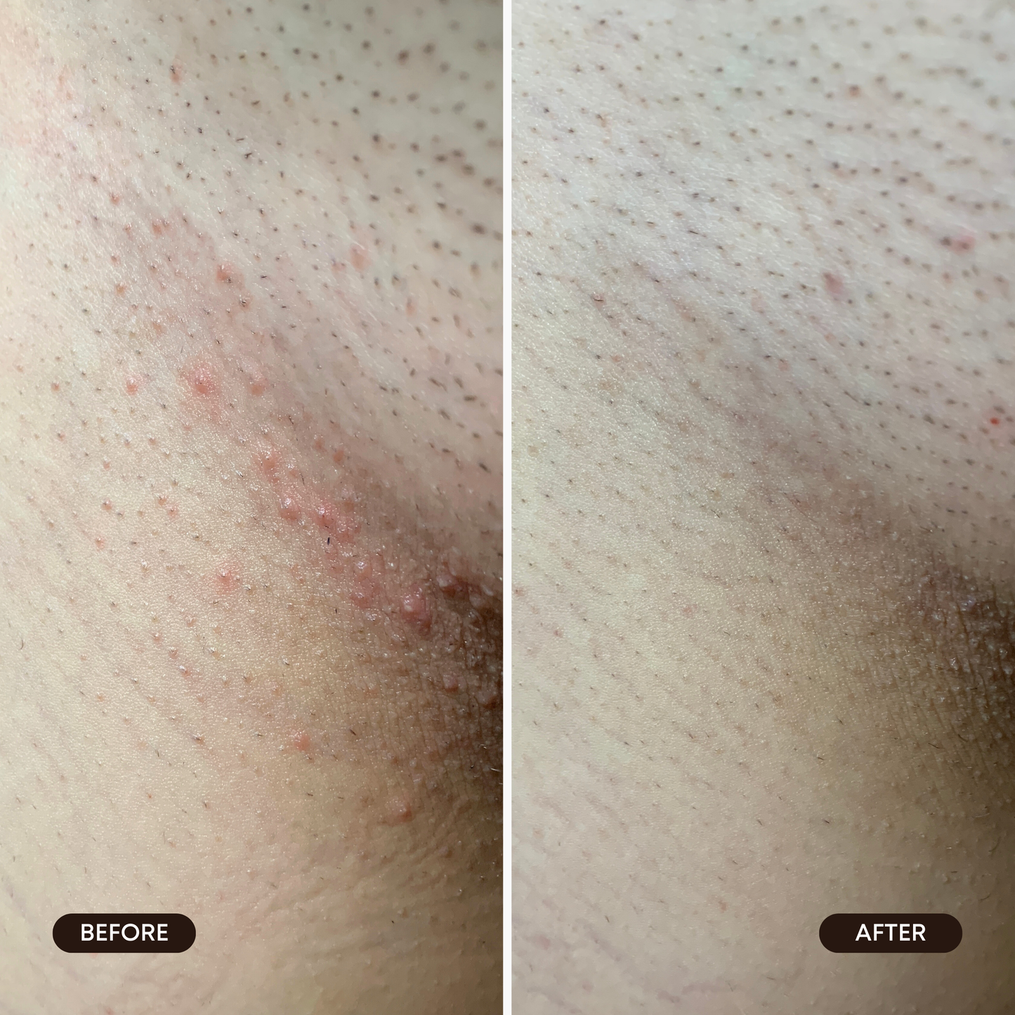 Bermuda Mini Dark Spot Oil