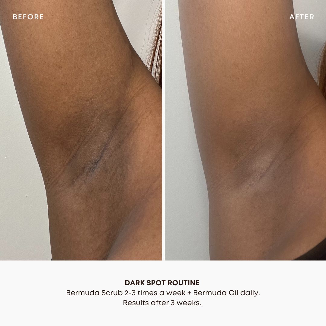 Bermuda Dark Spot 2 Step Routine
