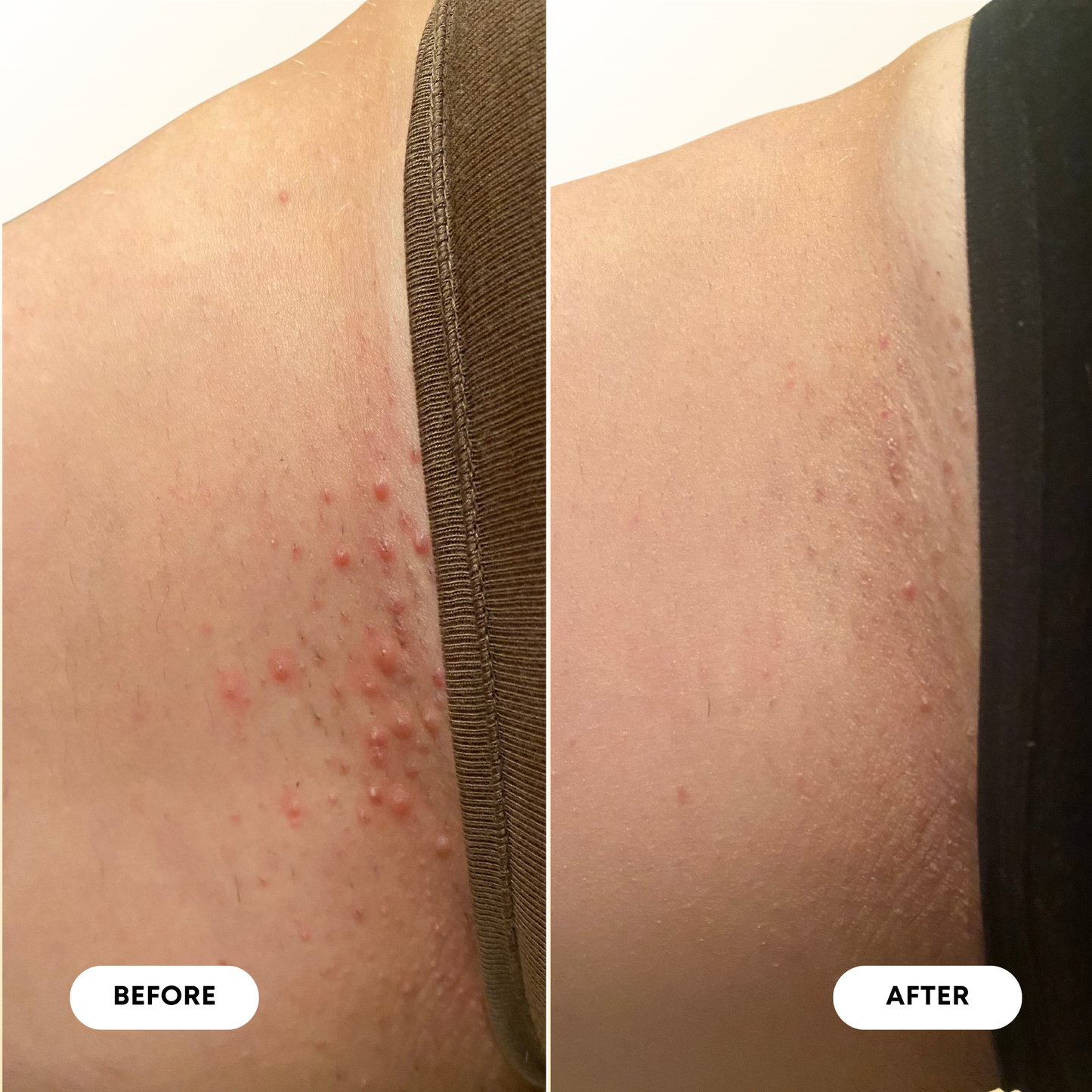 Milk & Honey Ingrown Hair Oil