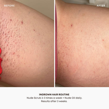 Nude Ingrown Hair Oil 3 Pack