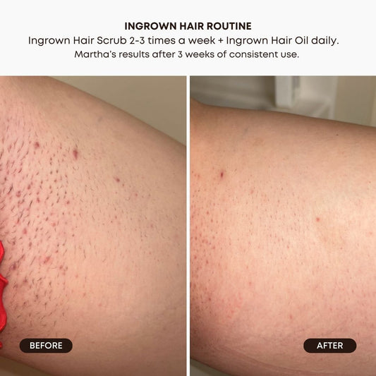 Watermelon Sugar Exfoliating Scrub