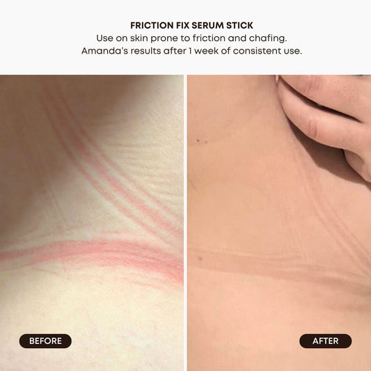 Skin Saviors Bundle